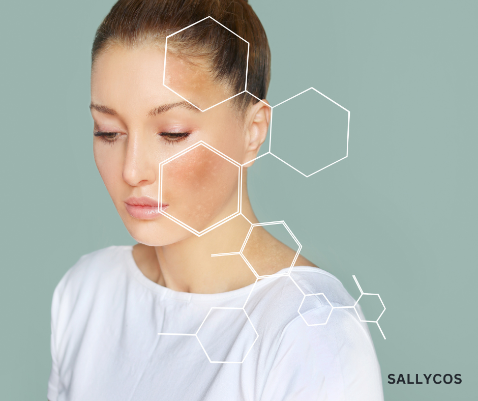 Hàng rào bảo vệ da là gì – cấu trúc skin barrier